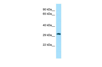 PIH1D1 Rabbit Polyclonal Antibody