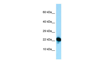 RPL18A Rabbit Polyclonal Antibody