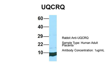 UQCRQ Rabbit Polyclonal Antibody