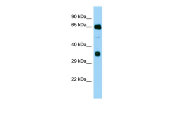 FARSB Rabbit Polyclonal Antibody