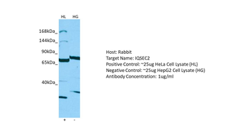 IQSEC2 Rabbit Polyclonal Antibody