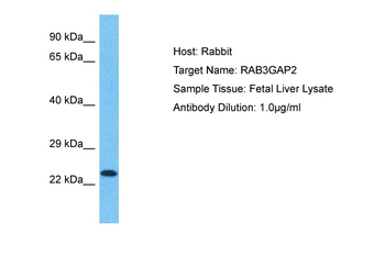 RAB3GAP2 Rabbit Polyclonal Antibody