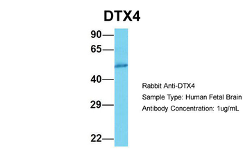 DTX4 Rabbit Polyclonal Antibody