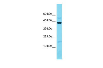 MRPL14 Rabbit Polyclonal Antibody