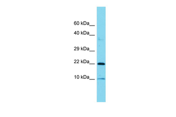 COPZ1 Rabbit Polyclonal Antibody