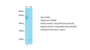 DBF4B Rabbit Polyclonal Antibody