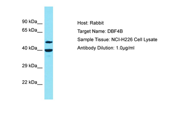 DBF4B Rabbit Polyclonal Antibody