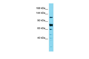DENND2A Rabbit Polyclonal Antibody