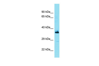 FBXL15 Rabbit Polyclonal Antibody