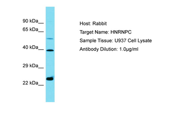 HNRNPC Rabbit Polyclonal Antibody