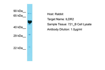 ILDR2 Rabbit Polyclonal Antibody