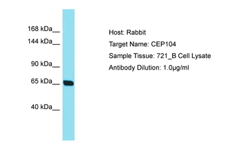 CEP104 Rabbit Polyclonal Antibody