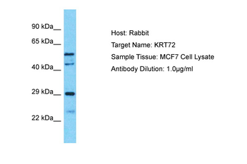 KRT72 Rabbit Polyclonal Antibody