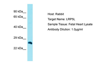 LRP5L Rabbit Polyclonal Antibody