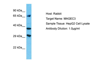 MAGEC3 Rabbit Polyclonal Antibody