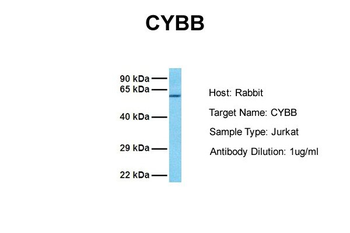 CYBB Rabbit Polyclonal Antibody