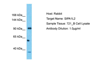 SIPA1L2 Rabbit Polyclonal Antibody
