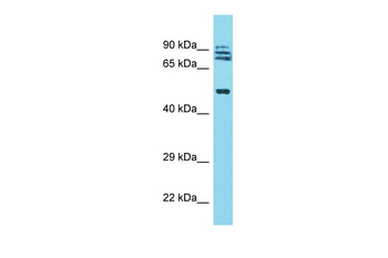 TRIM64 Rabbit Polyclonal Antibody