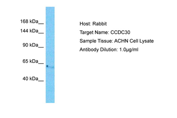 CCDC30 Rabbit Polyclonal Antibody