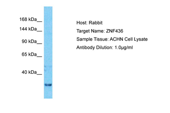 ZNF197 Rabbit Polyclonal Antibody