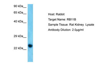 Rab11b Rabbit Polyclonal Antibody