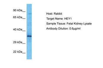 HEY1 Rabbit Polyclonal Antibody