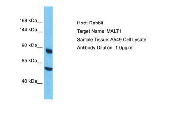 MALT1 Rabbit Polyclonal Antibody