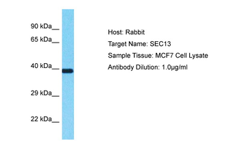 SEC13 Rabbit Polyclonal Antibody