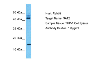 SAT2 Rabbit Polyclonal Antibody