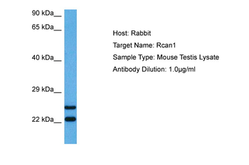 RCAN1 Rabbit Polyclonal Antibody