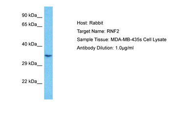 RNF2 Rabbit Polyclonal Antibody