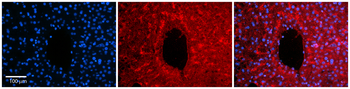 PKLR Rabbit Polyclonal Antibody