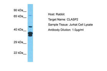CLASP2 Rabbit Polyclonal Antibody