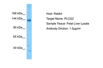 PLCG2 Rabbit Polyclonal Antibody