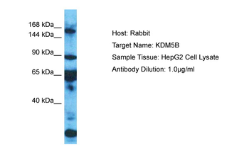 KDM5B Rabbit Polyclonal Antibody
