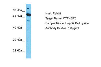 CTTNBP2 Rabbit Polyclonal Antibody
