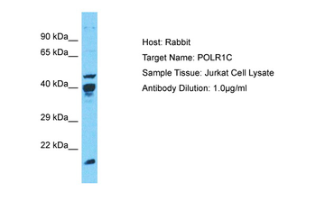 POLR1C Rabbit Polyclonal Antibody
