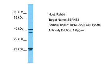 SEPHS1 Rabbit Polyclonal Antibody