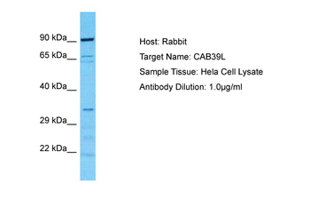 CAB39L Rabbit Polyclonal Antibody