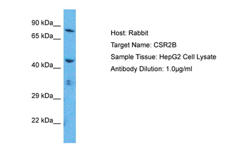 KAT14 Rabbit Polyclonal Antibody