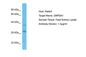 GNPDA1 Rabbit Polyclonal Antibody