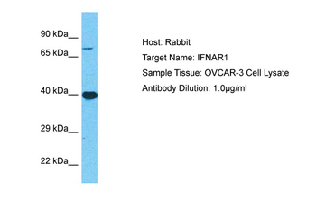 IFNAR1 Rabbit Polyclonal Antibody