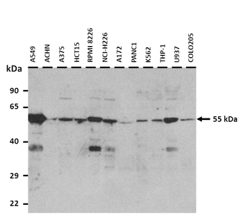 ALDH1A1 Rabbit Polyclonal Antibody