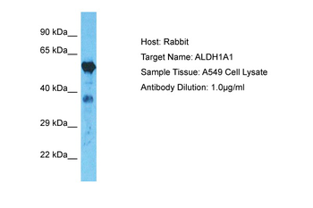 ALDH1A1 Rabbit Polyclonal Antibody