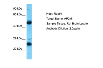 AP2M1 Rabbit Polyclonal Antibody