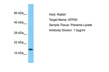 ATP5F1D Rabbit Polyclonal Antibody
