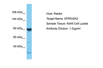 ATP6V0A2 Rabbit Polyclonal Antibody