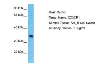 CX3CR1 Rabbit Polyclonal Antibody