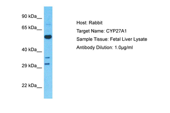 CYP27A1 Rabbit Polyclonal Antibody