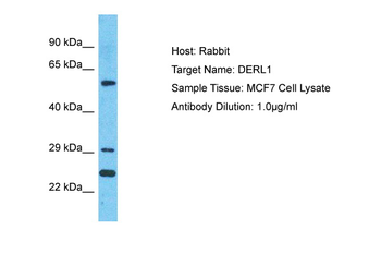 DERL1 Rabbit Polyclonal Antibody